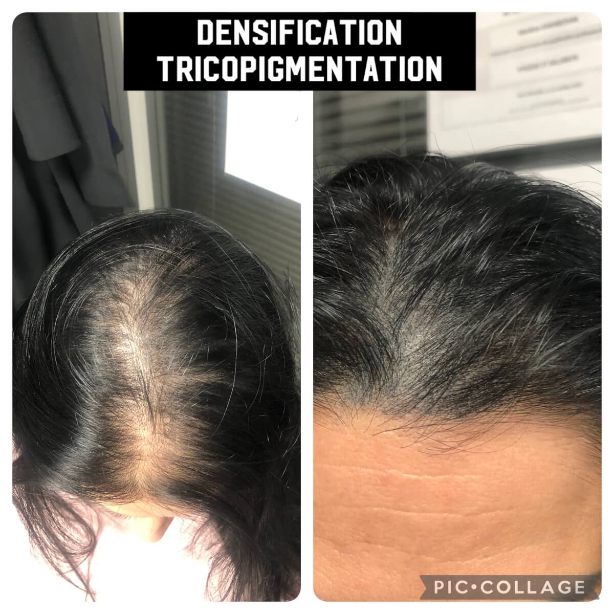 decouvrez-la-tricopigmentation-au-salon-le-mokka-a-six-fours